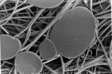 interfacing structure